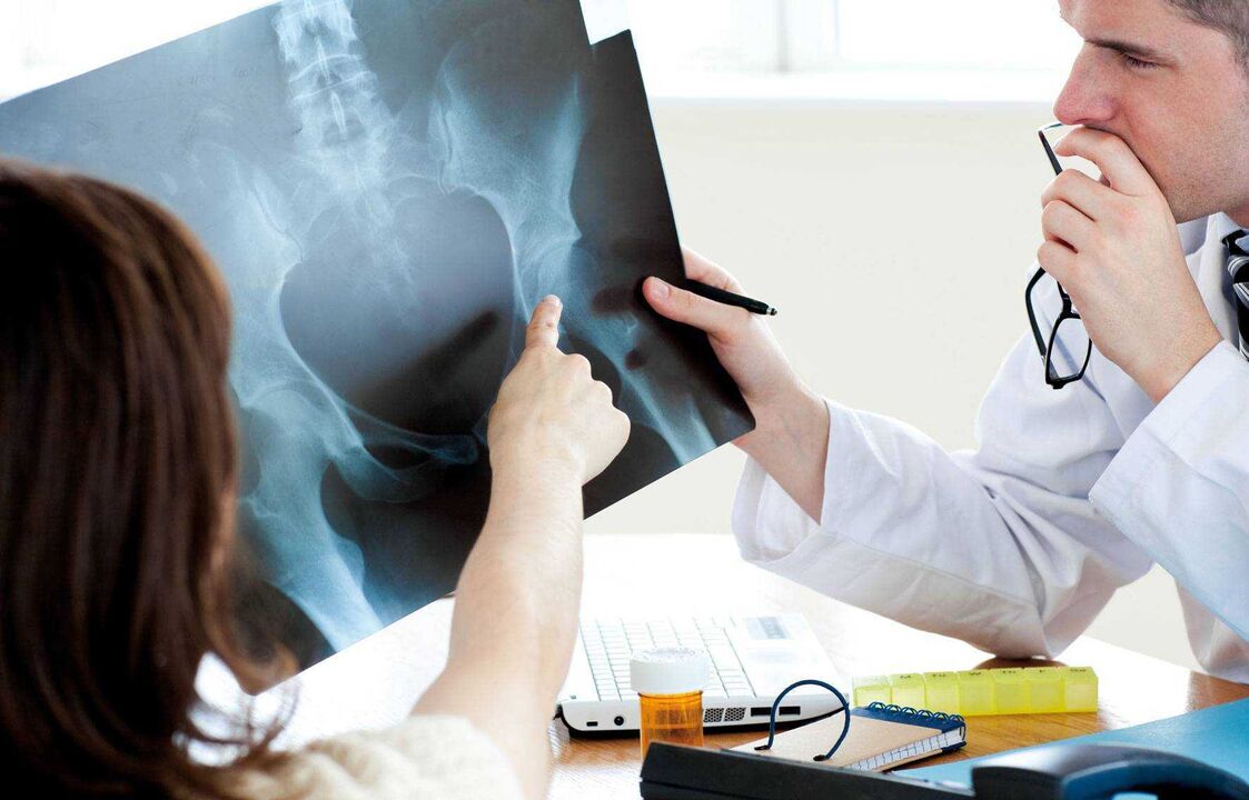 ärzte, die röntgenaufnahmen auf hüftarthrose untersuchen
